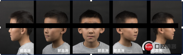 ‘开云官网’小麻花的做法_小麻花怎么做_食为悦己者美的菜谱(图2) 开云网页版